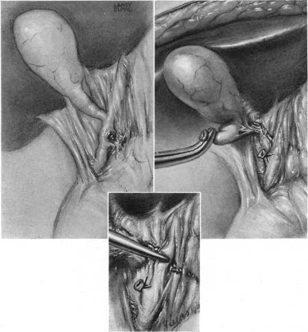 FIG. 1, 2.