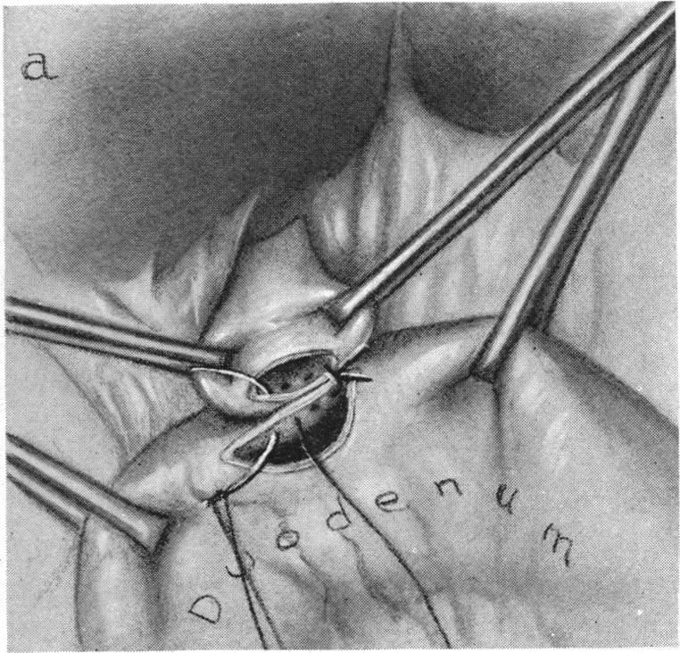 FIG. 10. a