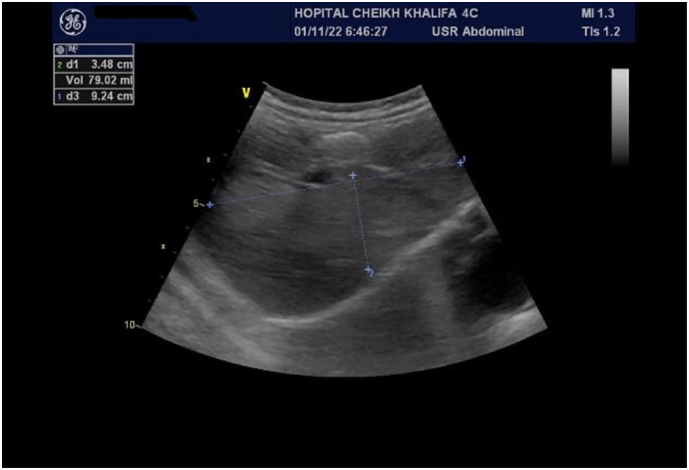 Fig. 5