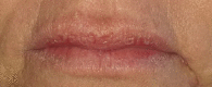 Figure 23