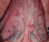 Figure 25