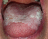 Figure 20