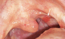 Figure 21