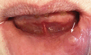 Figure 24