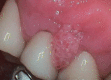 Figure 26