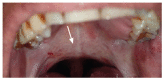 Figure 22