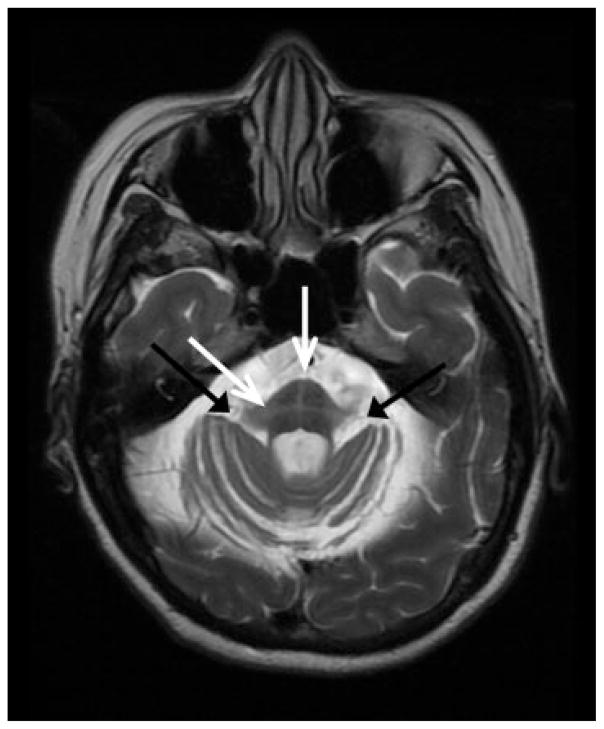 Fig. 10