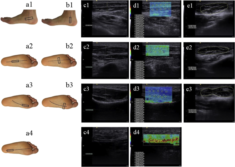 Fig. 1