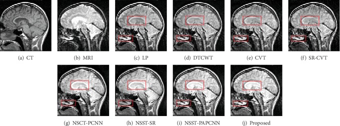 Figure 11