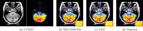 Figure 14