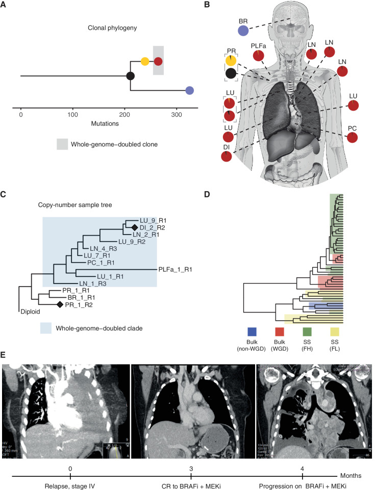 Figure 6. Identification of a likely non–whole-genome–doubled clone that was not identifiable from bulk sequencing data in CRUKP2567. Clonal phylogeny of CRUKP2567 (A), with anatomic diagram (B) based on bulk SNVs mapping samples to clones on the tree. The scale indicates the number of mutations. C, MEDICC2 copy-number tree for bulk exome samples from CRUKP2567. The cluster highlighted in blue has undergone one WGD event, while the other nonhighlighted cluster, containing brain metastasis and primary tumor samples, has not. Diamonds indicate the samples for which bulk copy-number profiles are displayed in Supplementary Fig. S23. D, Hierarchical clustering tree containing all single cells (SS) from FACs-high-ploidy sorting (FH) and FACs-low-ploidy sorting (FL), as well as WGD bulk samples and non-WGD bulk samples. E, Radiologic images of the patient indicating thorax upon initiation of stage IV disease and complete extracranial response to BRAF inhibitor, followed by rapid recolonization of the thorax with resistant clones (left to right). BR, brain; BRAFi, BRAF inhibitor; CR, complete response; DI, diaphragm; LN, lymph node; LU, lung; MEKi, MEK inhibitor; PC, pericardium, PLFa, pleural fluid (archival); PR, primary.