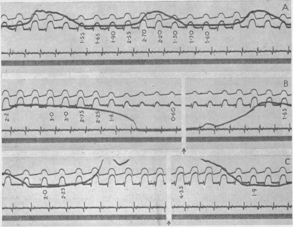 Fig. 11