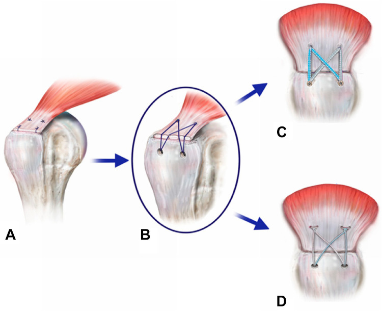 Figure 9.