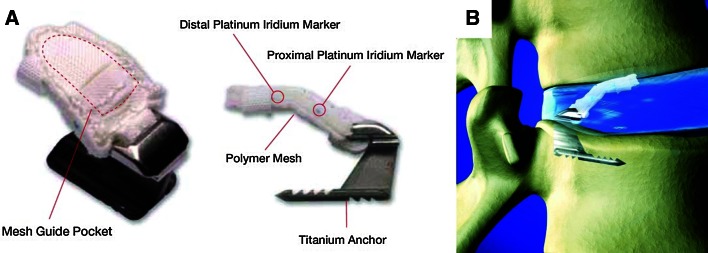 Fig. 1