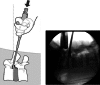 Fig. 2