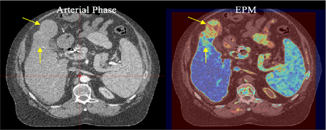 FIG. 9.