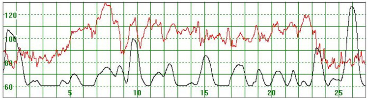 Figure 7.