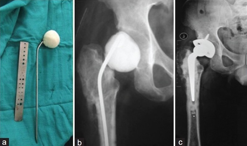 Figure 1B