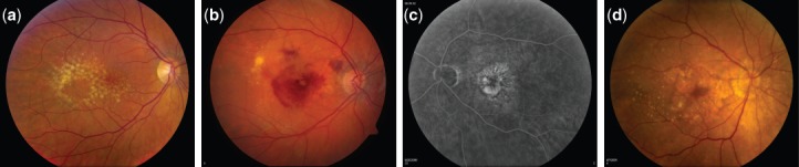 Fig. 1