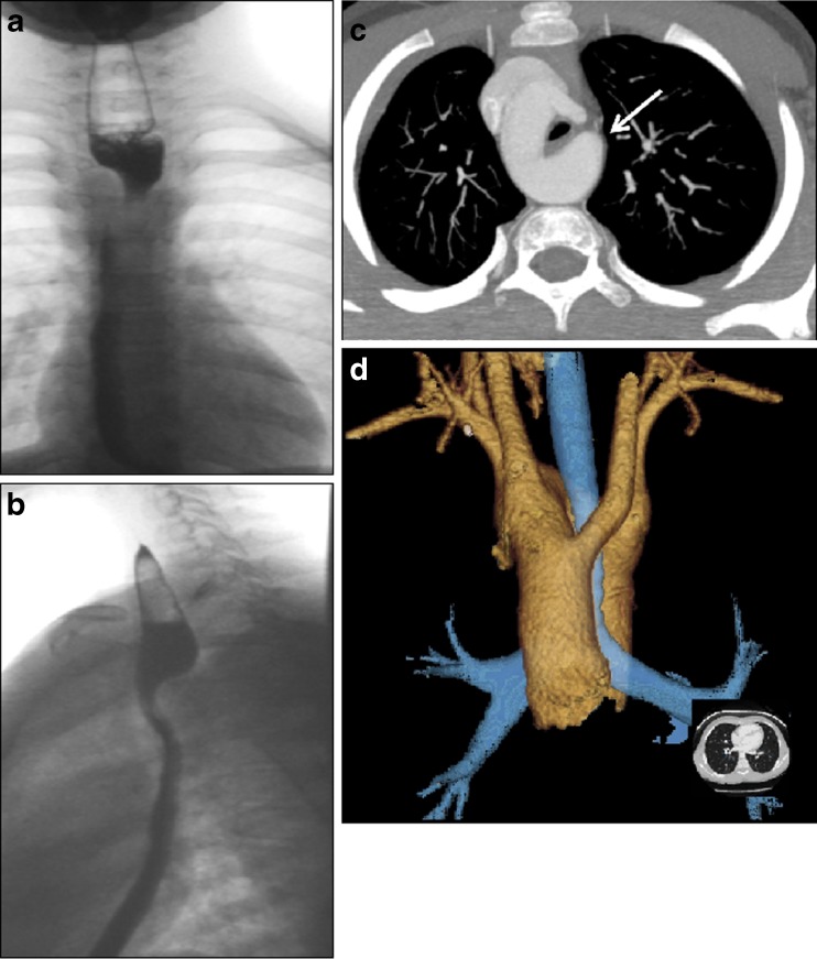 Fig. 13