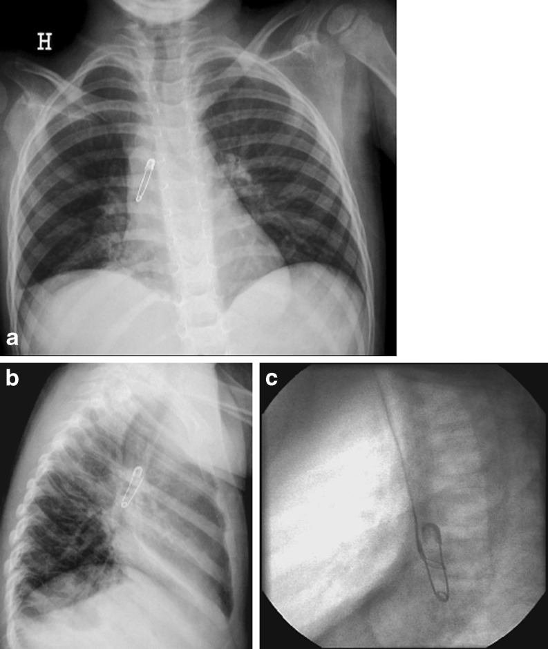 Fig. 10