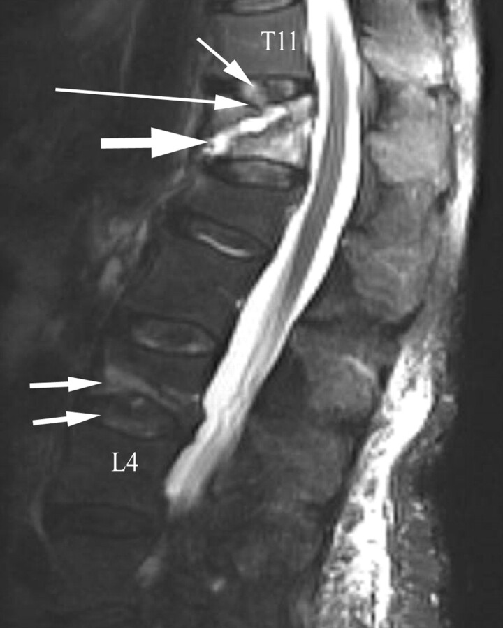 Fig 3.