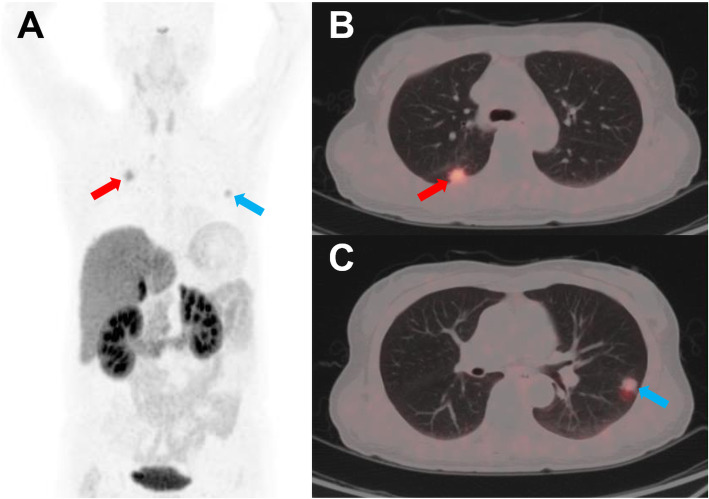 Fig. 5