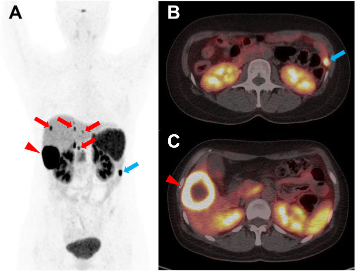 Fig. 4