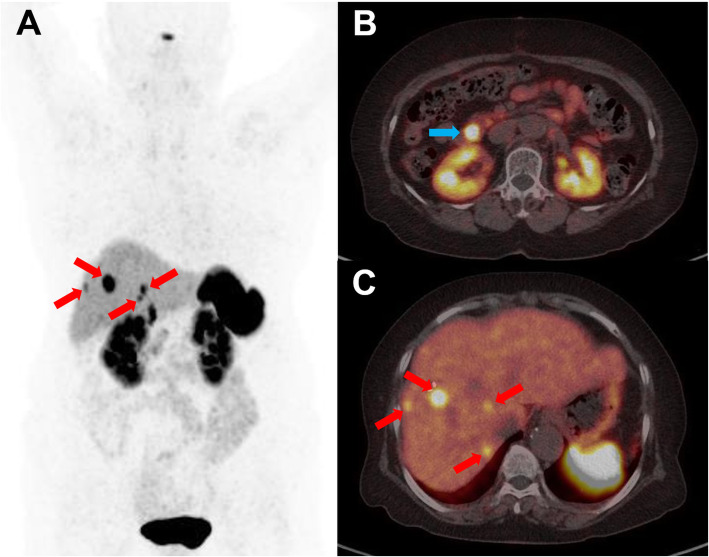 Fig. 3