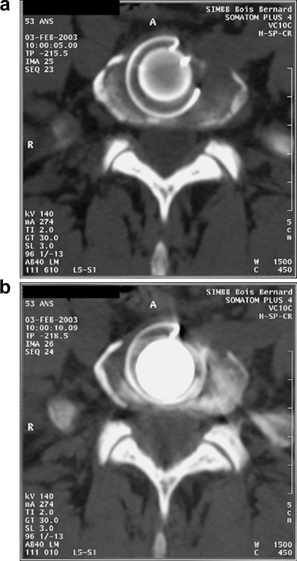 Fig. 3