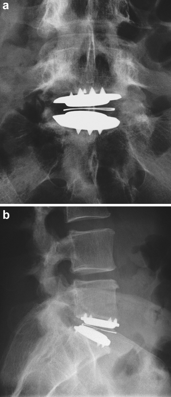 Fig. 4