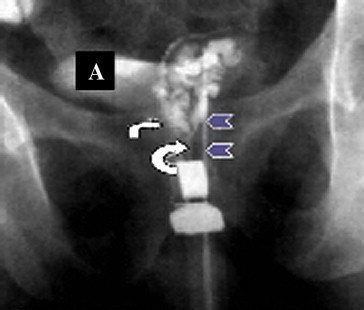 Fig. 1