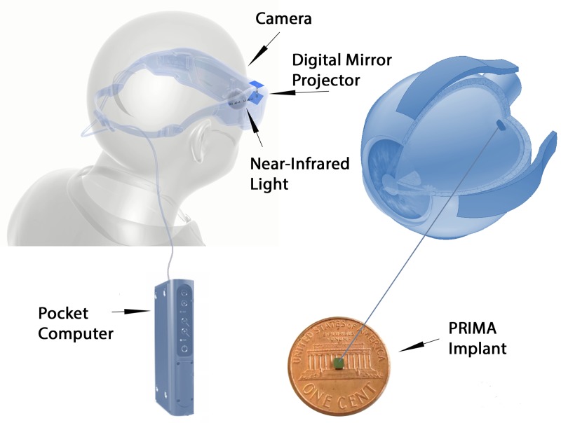 Fig 1