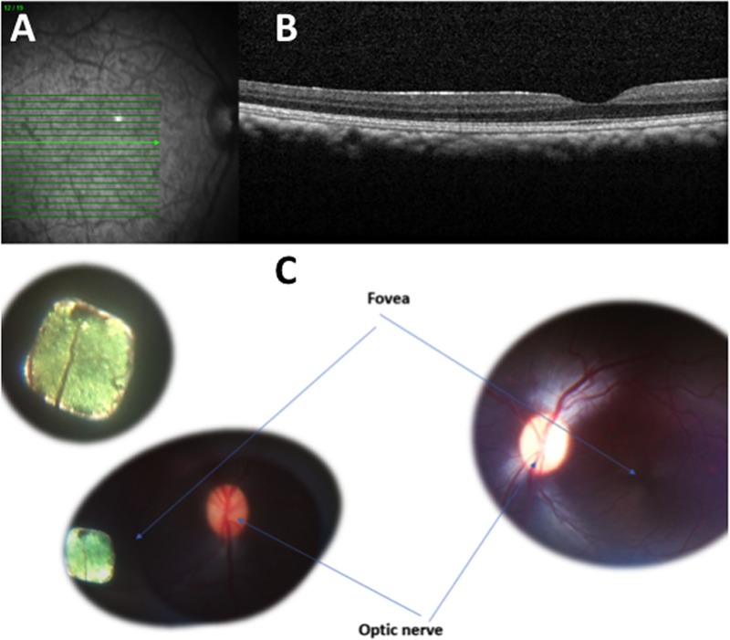 Fig 4