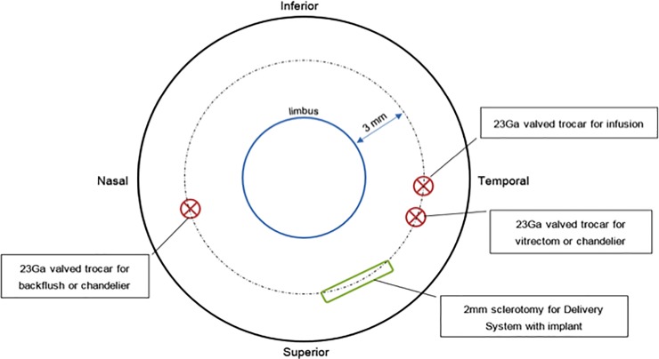 Fig 3