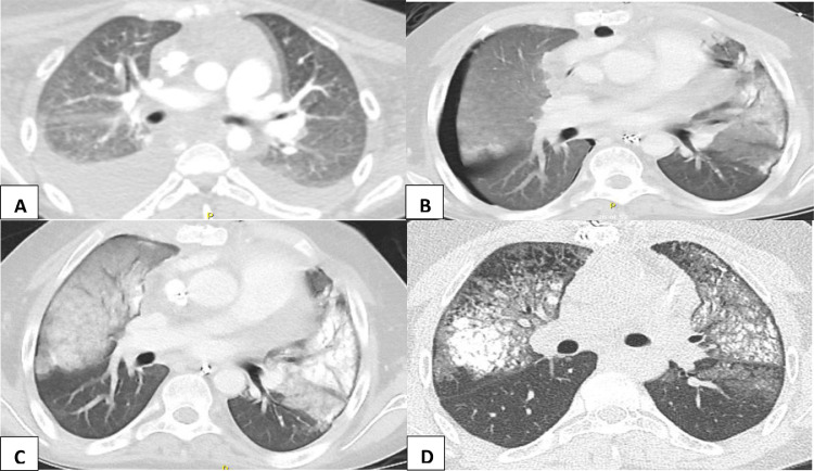 Fig 2 –