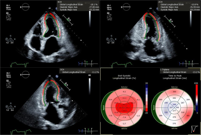 Fig. 3