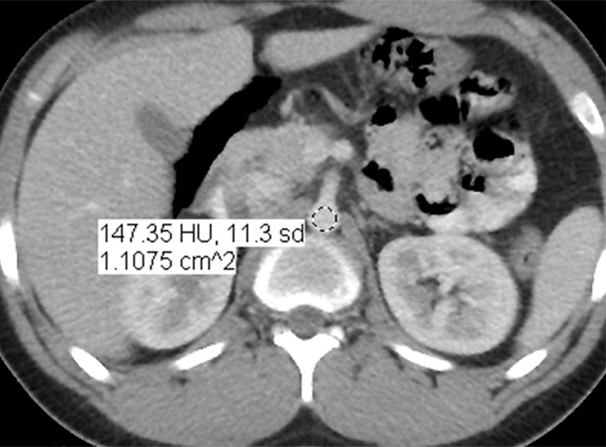 Figure 1b: