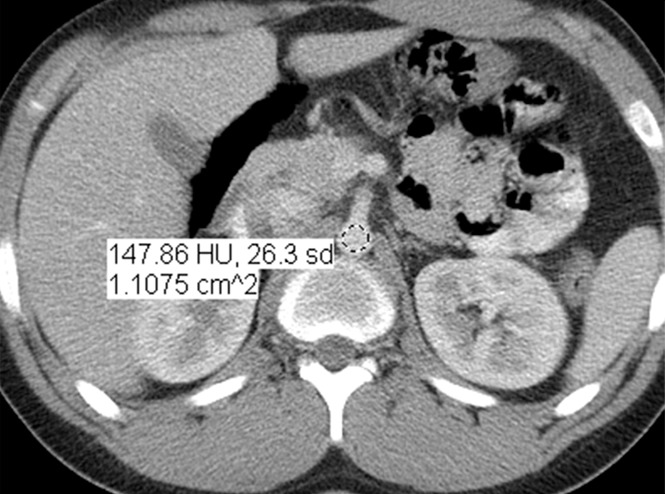 Figure 1c: