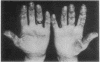 144