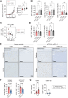 Figure 5. CD8+ T-cell abundance and distribution in CAF-rich and CAF-poor tumors. A, D2A1 cells alone or with GFP+ NMFs or CAFs were implanted orthotopically into BALB/c mice (n = 6–8 mice per group). Tumor growth curves and tumor growth rates. B–D, Primary tumors from A were analyzed via flow cytometry. B, % live GFP+, CD45-/Thy1.2+, and CD8+ T cells. C, Correlation between CD8+ and CD45−/Thy1.2+ cell number in all tumors. D, % Ki67+/CD8+ T cells and PD-1+/CD8+ T cells. E–G, D2A1 or D2A1-m2 cells were implanted orthotopically into BALB/c mice (n = 15–18 per group) and treated with αCTLA4 and αPD-L1 antibodies or isotype controls according to the schedule in Fig. 1E. E, Representative images of peripheral and central regions of tumors from isotype control and ICB-treated mice stained for CD8. Dotted line indicates tumor stroma boundary (scale bar, 250 μm). F, % of centrally located CD8+ T cells (see Supplementary Fig. S5A for the methodology of central and peripheral CD8+ T-cell quantification). G, CD8+ T-cell density in control (C) or ICB-treated tumors.