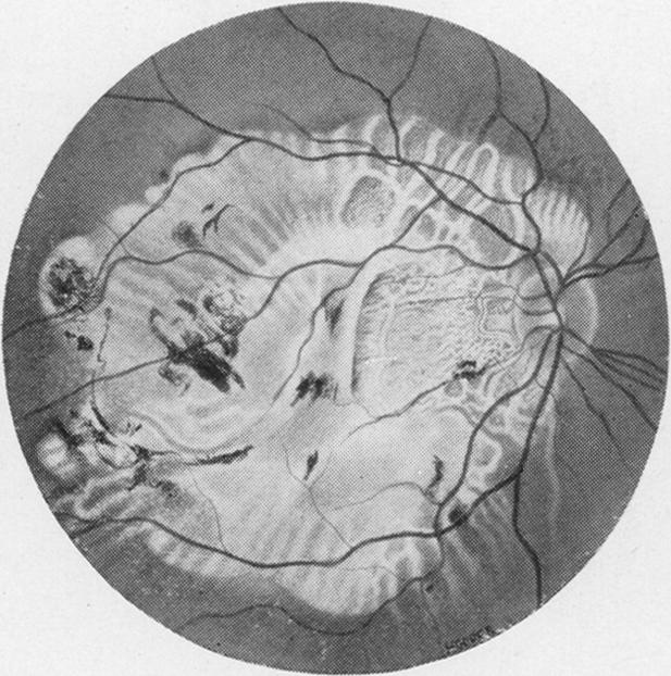 Fig. 3(a)