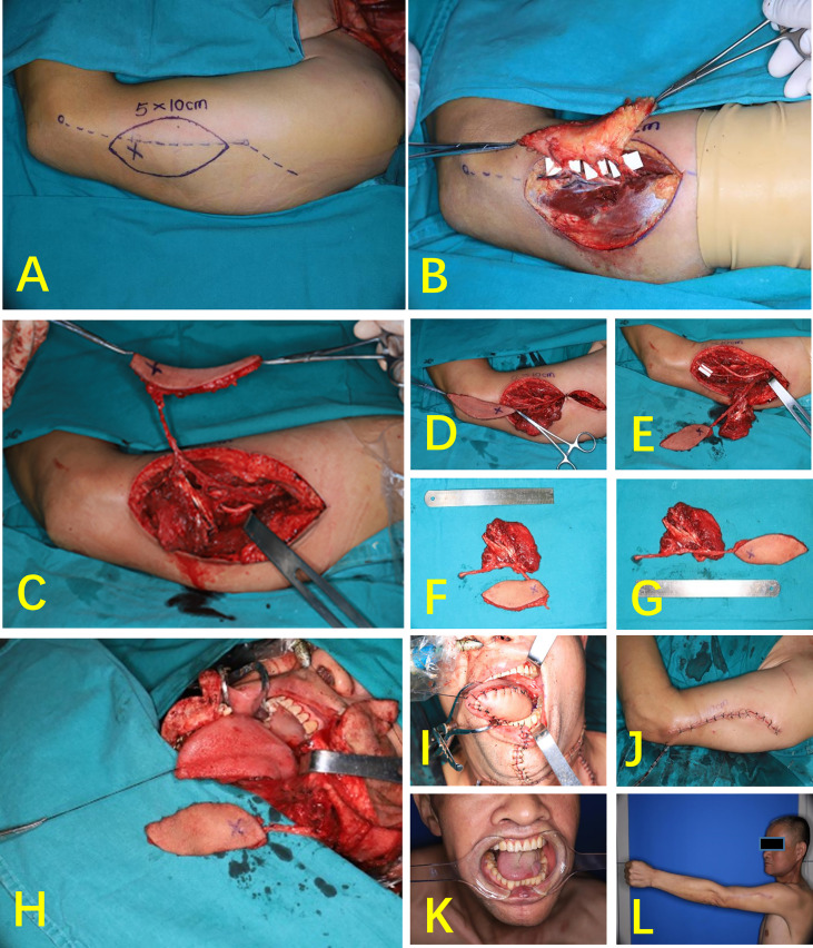 Figure 4