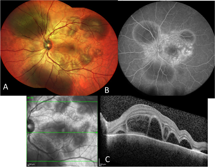 Fig. 1