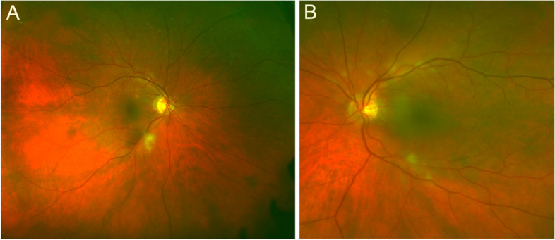 Fig. 3