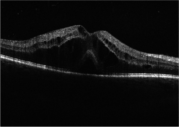 Fig. 2