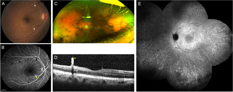 Fig. 6