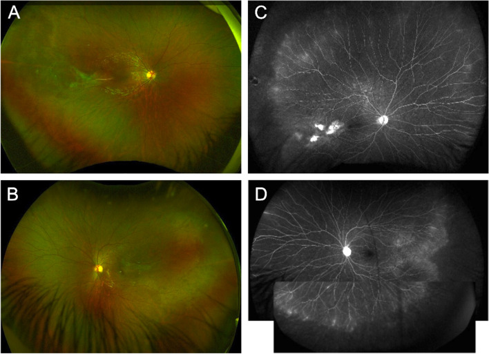 Fig. 4