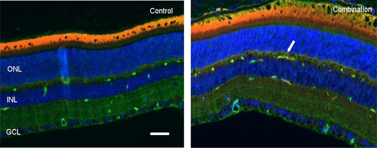 Figure 4: