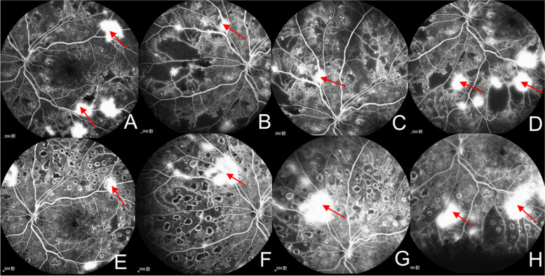 Fig. 4